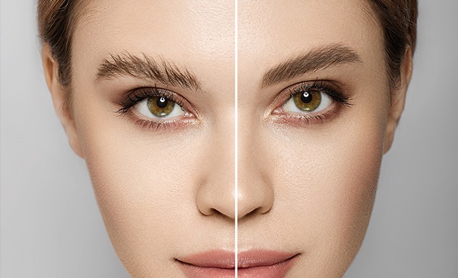 How Eyebrow Implants are Done: A Step By Step Guide Into The Process