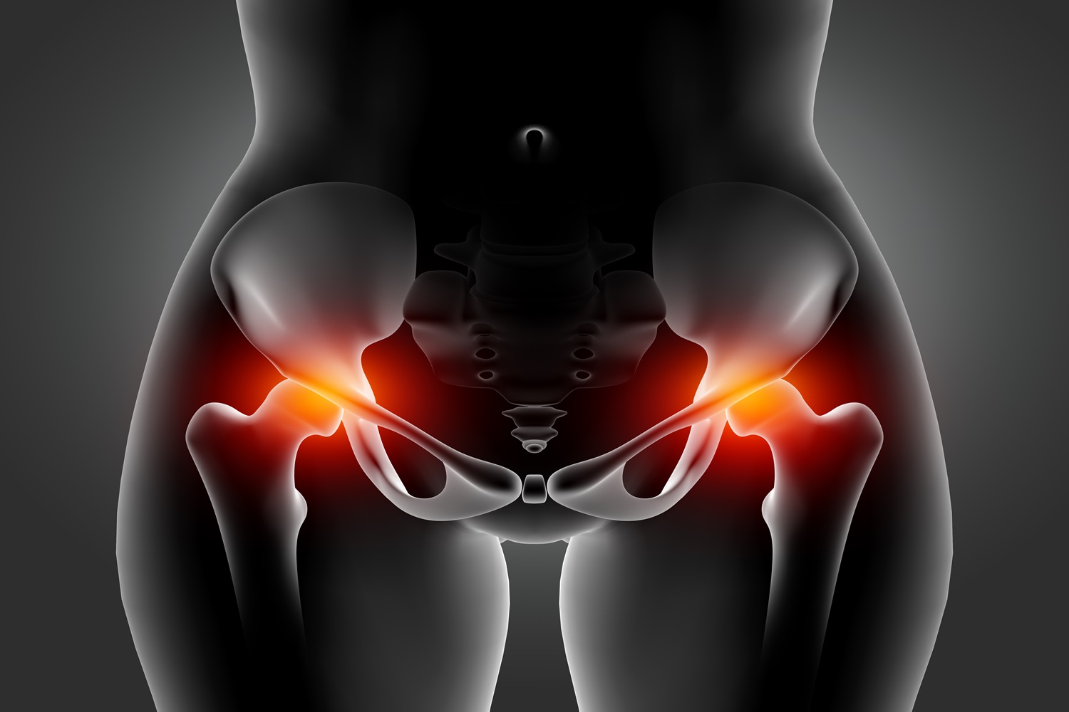 Hip Replacement Surgery